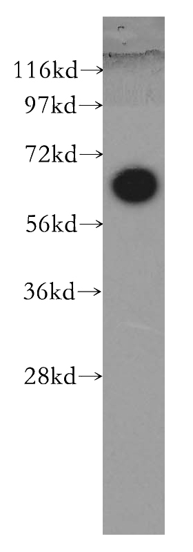 BxPC-3 cells were subjected to SDS PAGE followed by western blot with Catalog No:115267(SHC3 antibody) at dilution of 1:400