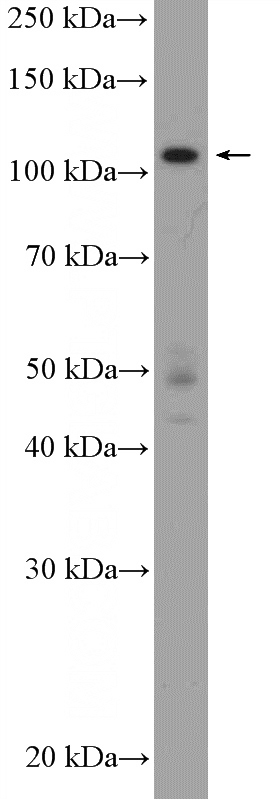 MCF-7 cells were subjected to SDS PAGE followed by western blot with Catalog No:111515(HNRNPUL2-Specific Antibody) at dilution of 1:300