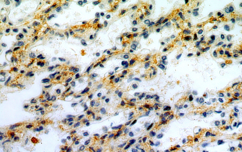 Immunohistochemical of paraffin-embedded human lung using Catalog No:113643(PDZD2 antibody) at dilution of 1:50 (under 40x lens)
