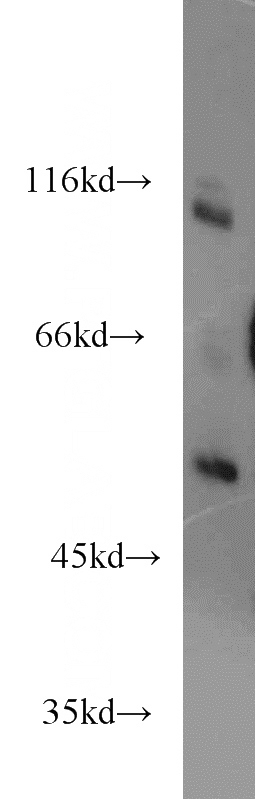 mouse brain tissue were subjected to SDS PAGE followed by western blot with Catalog No:114716(RIPK2 antibody) at dilution of 1:600