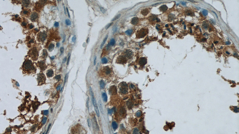 Immunohistochemistry of paraffin-embedded human testis tissue slide using Catalog No:117029(ZNF746 Antibody) at dilution of 1:50 (under 40x lens)