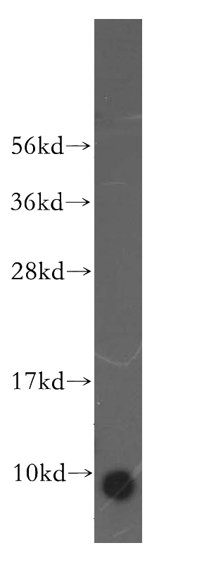 human brain tissue were subjected to SDS PAGE followed by western blot with Catalog No:108357(ATP5J antibody) at dilution of 1:800
