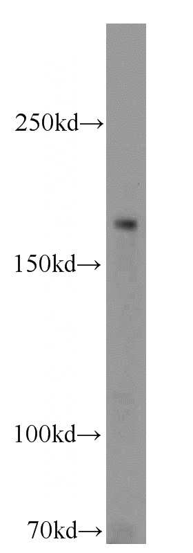 HeLa cells were subjected to SDS PAGE followed by western blot with Catalog No:114585(RB1CC1 antibody) at dilution of 1:1000