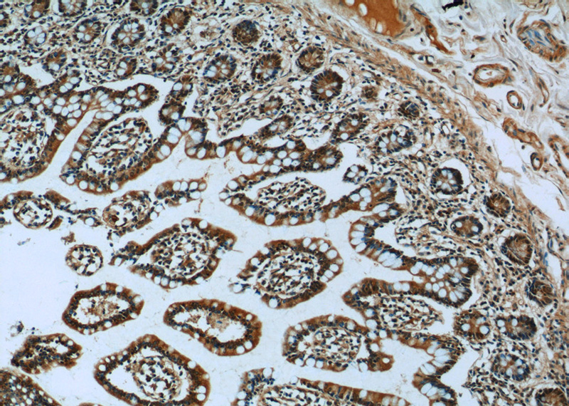 Immunohistochemistry of paraffin-embedded human small intestine tissue slide using Catalog No:109388(CLIC1 Antibody) at dilution of 1:50 (under 10x lens)