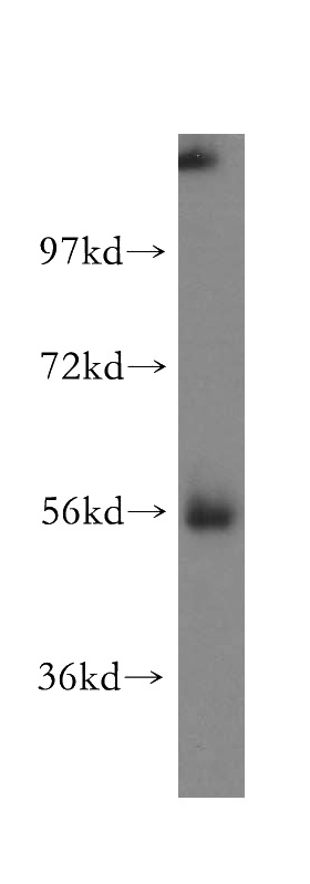human liver tissue were subjected to SDS PAGE followed by western blot with Catalog No:112536(MGAT2 antibody) at dilution of 1:500