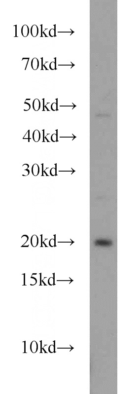 K-562 cells were subjected to SDS PAGE followed by western blot with Catalog No:114549(RAP2A antibody) at dilution of 1:1000