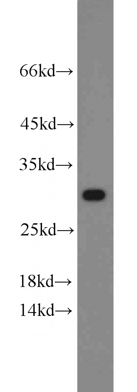 HeLa cells were subjected to SDS PAGE followed by western blot with Catalog No:114216(PHB antibody) at dilution of 1:1000