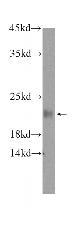 human testis tissue were subjected to SDS PAGE followed by western blot with Catalog No:112037(C6orf221 Antibody) at dilution of 1:600