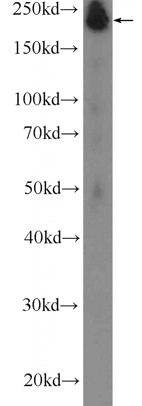 human skeletal muscle tissue were subjected to SDS PAGE followed by western blot with Catalog No:112934(MYH4-Specific Antibody) at dilution of 1:300