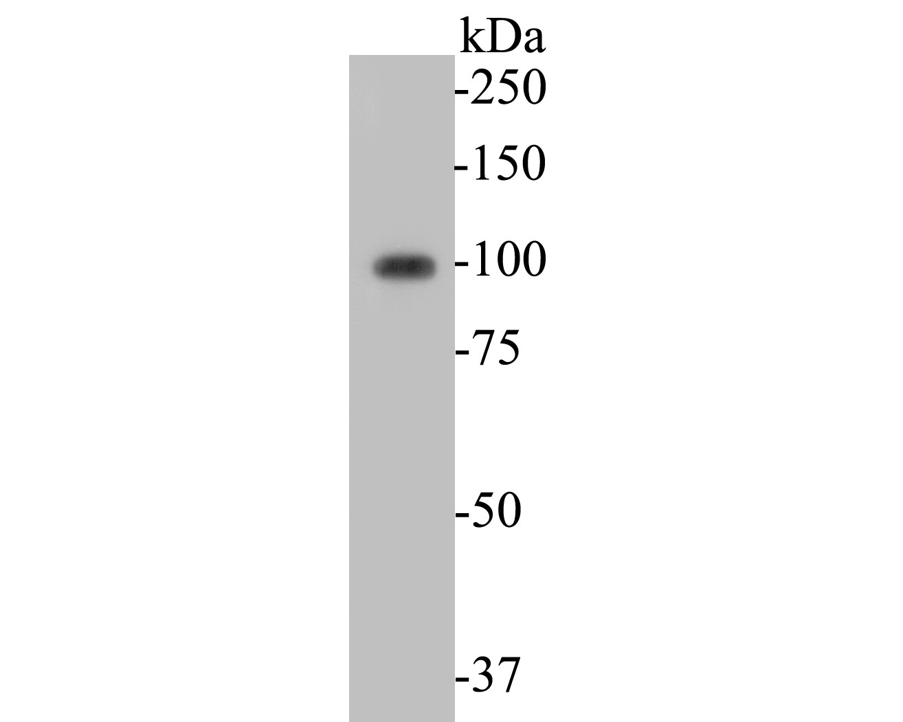 Fig1: Western blot analysis of KCNB1 on rat cerebellum tissue lysates. Proteins were transferred to a PVDF membrane and blocked with 5% BSA in PBS for 1 hour at room temperature. The primary antibody ( 1/500) was used in 5% BSA at room temperature for 2 hours. Goat Anti-Rabbit IgG - HRP Secondary Antibody (HA1001) at 1:5,000 dilution was used for 1 hour at room temperature.