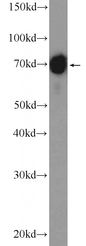 Jurkat cells were subjected to SDS PAGE followed by western blot with Catalog No:112874(MSN Antibody) at dilution of 1:1000