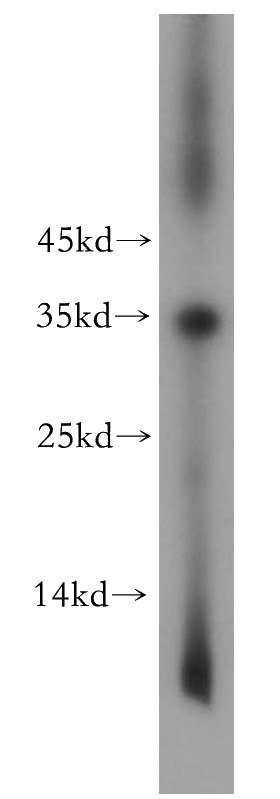 mouse skeletal muscle tissue were subjected to SDS PAGE followed by western blot with Catalog No:116154(TNNT1 antibody) at dilution of 1:1500
