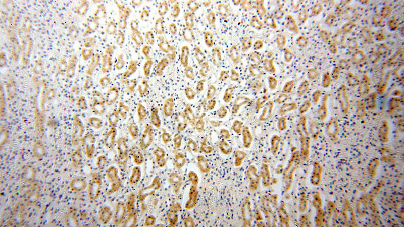 Immunohistochemical of paraffin-embedded human kidney using Catalog No:113069(NDUFB1 antibody) at dilution of 1:100 (under 10x lens)