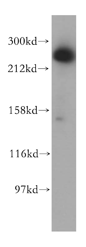 HeLa cells were subjected to SDS PAGE followed by western blot with Catalog No:108220(ASCC3 antibody) at dilution of 1:400
