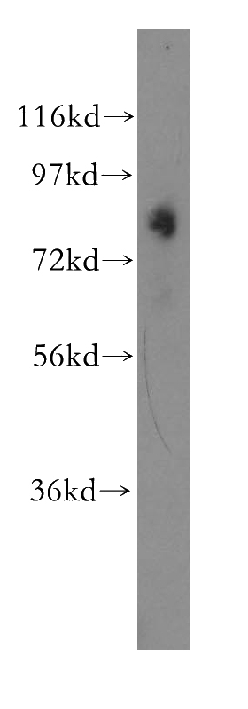 human skeletal muscle tissue were subjected to SDS PAGE followed by western blot with Catalog No:113430(OSBPL11 antibody) at dilution of 1:500