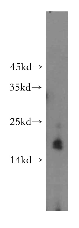 HeLa cells were subjected to SDS PAGE followed by western blot with Catalog No:112840(MRPS11 antibody) at dilution of 1:500