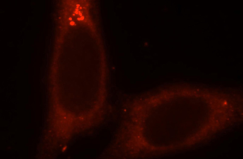 Immunofluorescent analysis of HepG2 cells, using SMU1 antibody Catalog No:115404 at 1:25 dilution and Rhodamine-labeled goat anti-rabbit IgG (red).