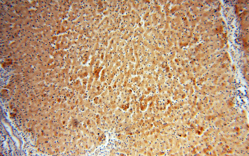 Immunohistochemical of paraffin-embedded human liver using Catalog No:109240(CHKA antibody) at dilution of 1:50 (under 10x lens)