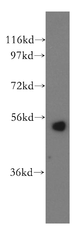 Jurkat cells were subjected to SDS PAGE followed by western blot with Catalog No:115655(SPTLC1 antibody) at dilution of 1:500
