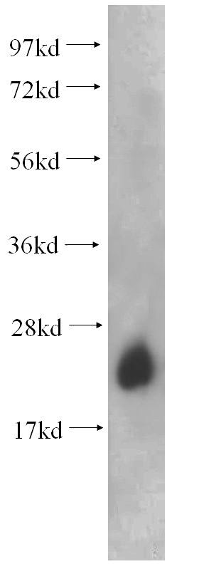 mouse brain tissue were subjected to SDS PAGE followed by western blot with Catalog No:114456(RAB6A antibody) at dilution of 1:500