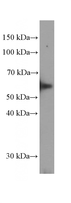 DU 145 cells were subjected to SDS PAGE followed by western blot with Catalog No:107486(SLC45A3 Antibody) at dilution of 1:2000