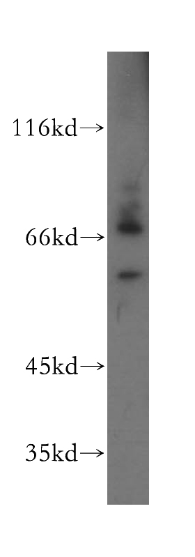 human heart tissue were subjected to SDS PAGE followed by western blot with Catalog No:110712(FOXP4 antibody) at dilution of 1:800