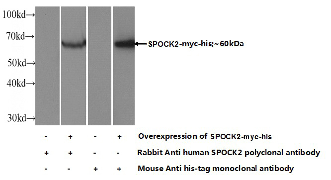Transfected HEK-293 cells were subjected to SDS PAGE followed by western blot with Catalog No:115579(SPocK2 Antibody) at dilution of 1:1000
