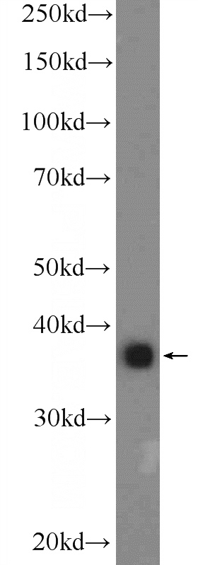 A549 cells were subjected to SDS PAGE followed by western blot with Catalog No:108033(APOL2 Antibody) at dilution of 1:2000