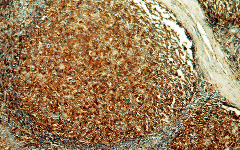 Immunohistochemical of paraffin-embedded human tonsil using Catalog No:111425(HLA-DRA antibody) at dilution of 1:50 (under 10x lens)