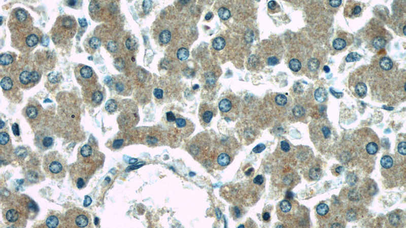 Immunohistochemical of paraffin-embedded human liver using Catalog No:111154(ARHGAP26 antibody) at dilution of 1:50 (under 40x lens)