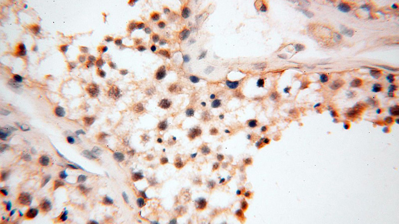 Immunohistochemical of paraffin-embedded human testis using Catalog No:112112(KPNA1 antibody) at dilution of 1:100 (under 40x lens)