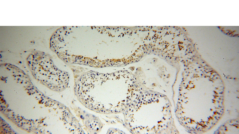 Immunohistochemical of paraffin-embedded human testis using Catalog No:116659(UBQLN3 antibody) at dilution of 1:100 (under 10x lens)