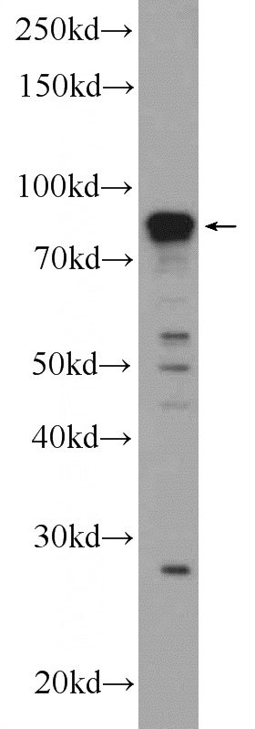 Neuro-2a cells were subjected to SDS PAGE followed by western blot with Catalog No:110460(FAM114A1 Antibody) at dilution of 1:300