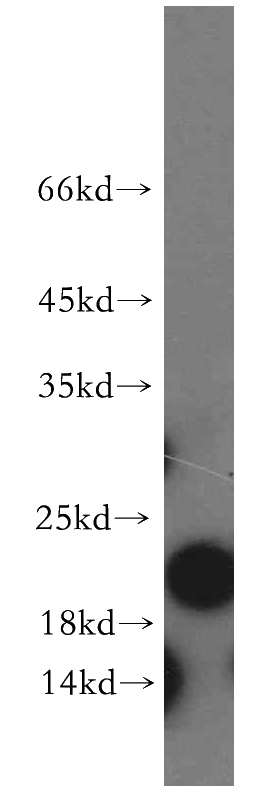 mouse colon tissue were subjected to SDS PAGE followed by western blot with Catalog No:108248(ARF5-Specific antibody) at dilution of 1:300