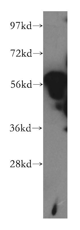 K-562 cells were subjected to SDS PAGE followed by western blot with Catalog No:116875(XRCC4 antibody) at dilution of 1:1000