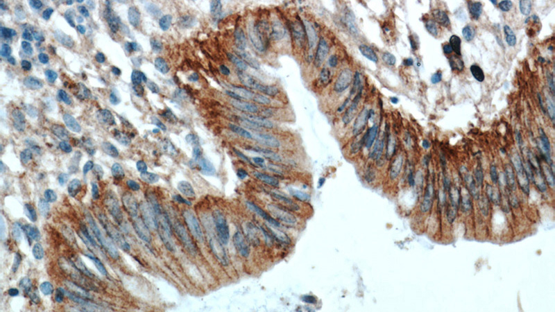 Immunohistochemical of paraffin-embedded human colon using Catalog No:112149(LARS antibody) at dilution of 1:100 (under 40x lens)