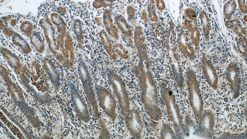 Immunohistochemical of paraffin-embedded human stomach using Catalog No:113383(NUP85 antibody) at dilution of 1:50 (under 10x lens)