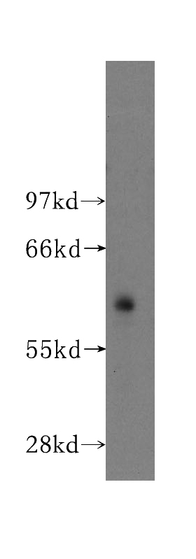 human lung tissue were subjected to SDS PAGE followed by western blot with Catalog No:108346(ATP1B3 antibody) at dilution of 1:300