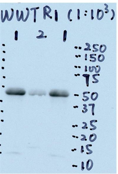 WB result of WWTR1 antibody (TAZ antibody, Catalog No:115860, 1:1000) with LN229 cell lysate by Dr. Xiaobing He. (Lane 1, LN229 (GBM cell line) cell lysate. 90 ug; Lane 2, LN229 growth inhibition treatment. 90 ug)