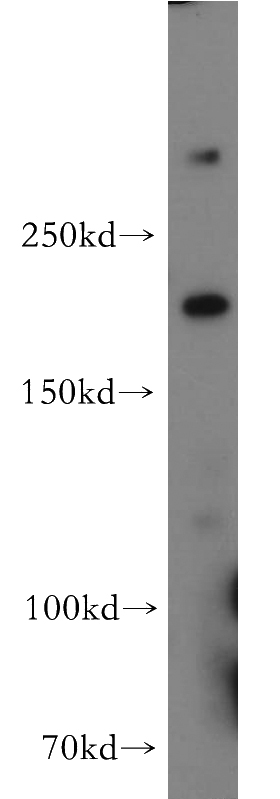HEK-293 cells were subjected to SDS PAGE followed by western blot with Catalog No:111279(HCFC1 antibody) at dilution of 1:500