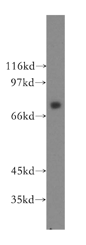 Raji cells were subjected to SDS PAGE followed by western blot with Catalog No:109415(CMIP antibody) at dilution of 1:400
