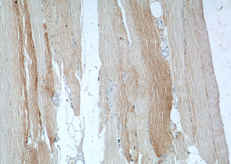 Immunohistochemistry of paraffin-embedded human skeletal muscle tissue slide using Catalog No:110103(DNAJC11 Antibody) at dilution of 1:50 (under 10x lens)