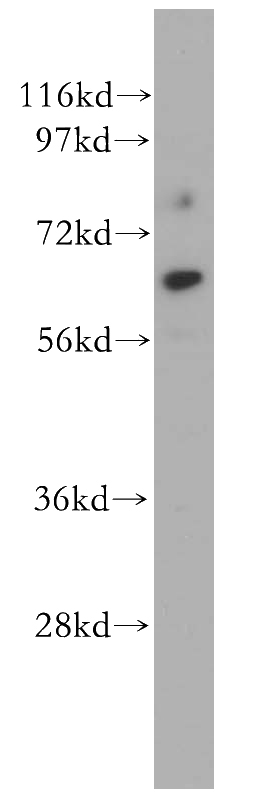SH-SY5Y cells were subjected to SDS PAGE followed by western blot with Catalog No:109173(CDR2L antibody) at dilution of 1:500