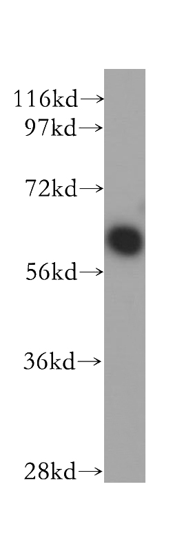 mouse brain tissue were subjected to SDS PAGE followed by western blot with Catalog No:114399(PSMD3 antibody) at dilution of 1:500