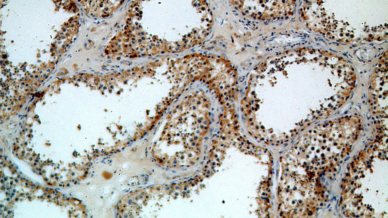 Immunohistochemical of paraffin-embedded human testis using Catalog No:109333(CLASP1 antibody) at dilution of 1:100 (under 10x lens)