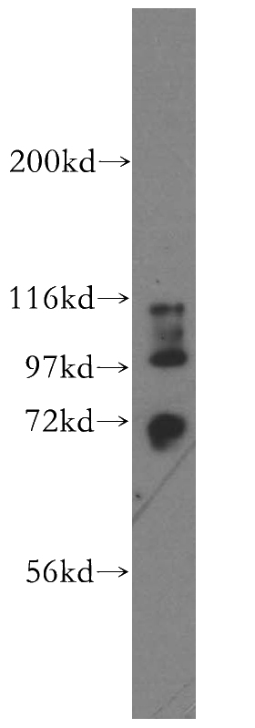 HepG2 cells were subjected to SDS PAGE followed by western blot with Catalog No:115811(STXBP3 antibody) at dilution of 1:800