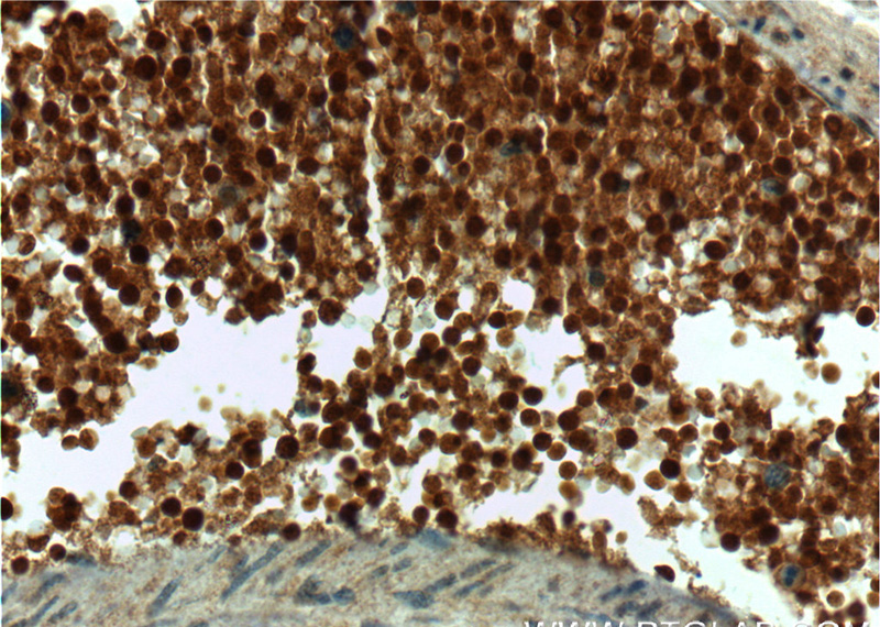 Immunohistochemistry of paraffin-embedded human stomach tissue slide using Catalog No:111982(KIAA0494 Antibody) at dilution of 1:50 (under 40x lens)