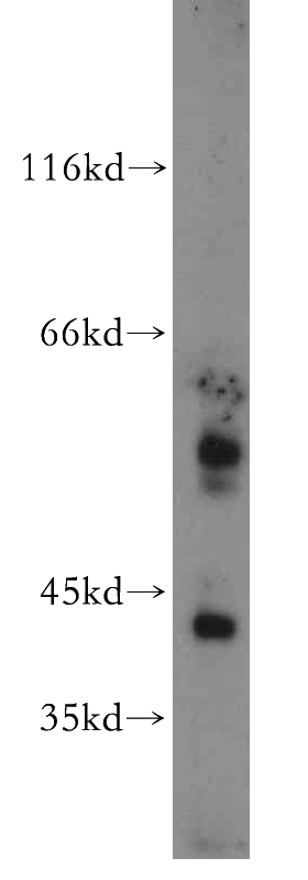 mouse lung tissue were subjected to SDS PAGE followed by western blot with Catalog No:116855(WDR13 antibody) at dilution of 1:300