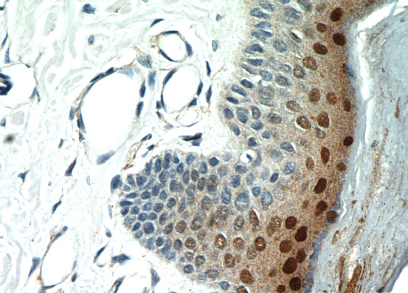 Immunohistochemical of paraffin-embedded human skin using Catalog No:112079(SP6 antibody) at dilution of 1:100 (under 40x lens)