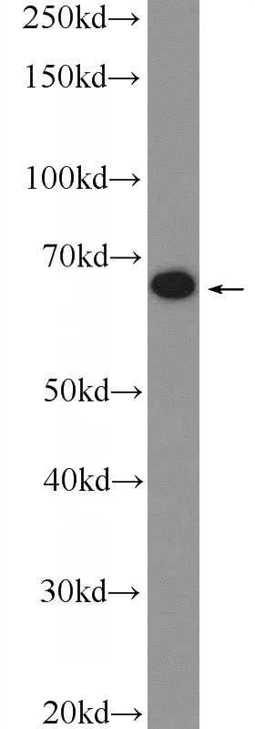 Jurkat cells were subjected to SDS PAGE followed by western blot with Catalog No:112540(MBTD1 Antibody) at dilution of 1:600
